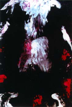 2-